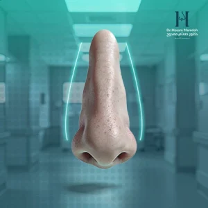 الانف الطويل