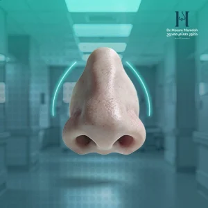 الانف العريض