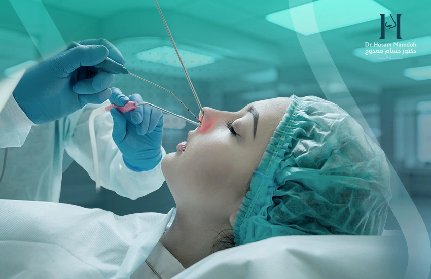 تصغير قرنيات الأنف