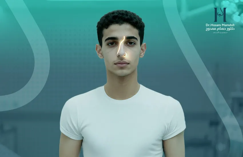 عملية اعوجاج الحاجز الأنفي